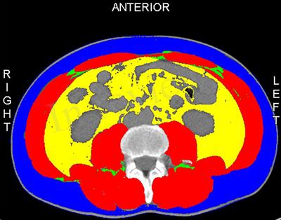 Developing and validating a nomogram based on skeletal muscle index and clinical scoring system for prediction of liver failure after hepatectomy